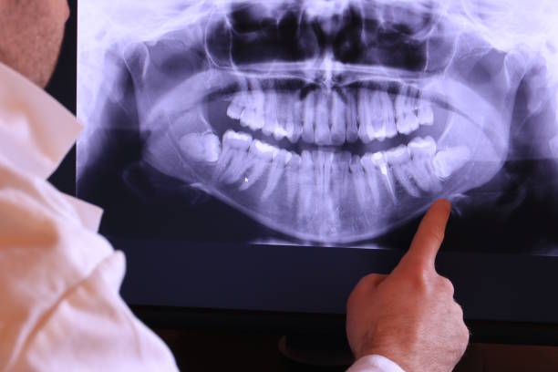 Best Walk-In Emergency Dental Services in Holly Springs, NC